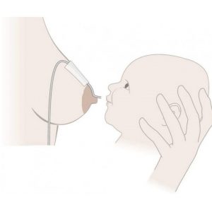 Medela SNS (Supplemental Nursing System) система поддержки кормления — изображение 5