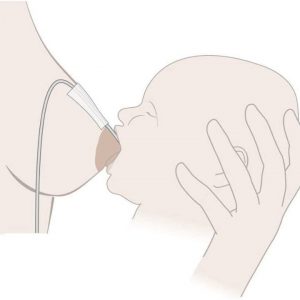 Дополнительная система кормления Medela SNS (Supplemental Nursing System) — изображение 9