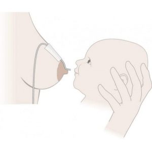 Дополнительная система кормления Medela SNS (Supplemental Nursing System) — изображение 4