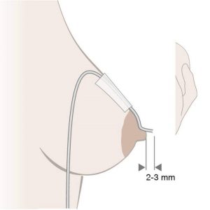 Дополнительная система кормления Medela SNS (Supplemental Nursing System) — изображение 5